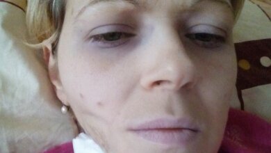 «Я в отчаянии, но надо биться до последнего», - молодая мама из Корабельного района просит о помощи | Корабелов.ИНФО image 1
