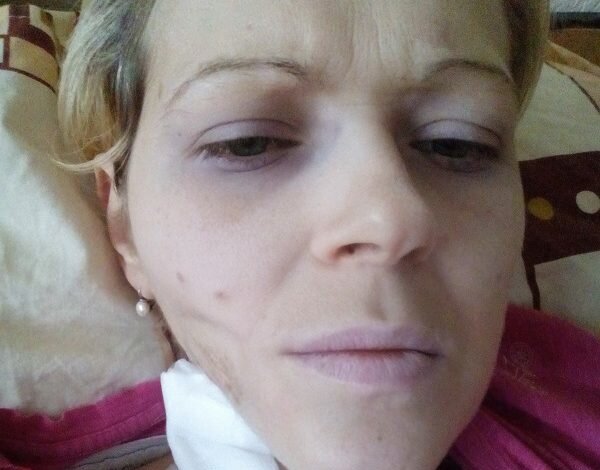 «Я в отчаянии, но надо биться до последнего», - молодая мама из Корабельного района просит о помощи | Корабелов.ИНФО image 1