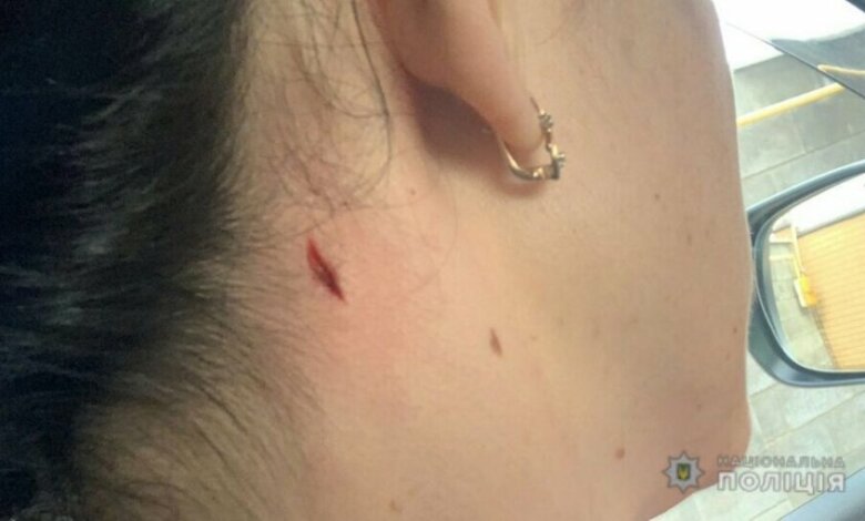 Женщина, выгуливая собак возле стрельбища в Николаеве, получила пулевое ранение | Корабелов.ИНФО