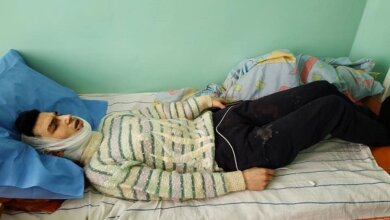 19-летний парень тяжело ранил ножом николаевца, у которого жил в квартире | Корабелов.ИНФО image 2