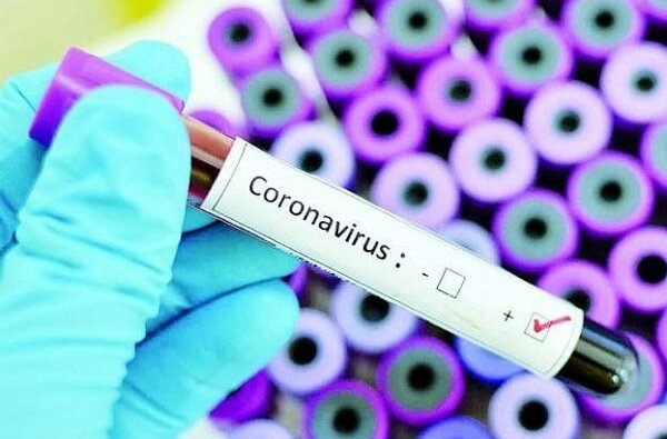 Тесты на коронавирус получили восемь областей, Николаевской в этом списке нет | Корабелов.ИНФО