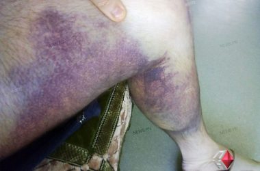 «Где кровь, где моча?!», - николаевец рассказал, как его избивали в Витовском отделении полиции (Видео) | Корабелов.ИНФО image 1