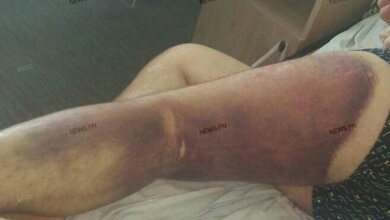 «Где кровь, где моча?!», - николаевец рассказал, как его избивали в Витовском отделении полиции (Видео) | Корабелов.ИНФО image 2