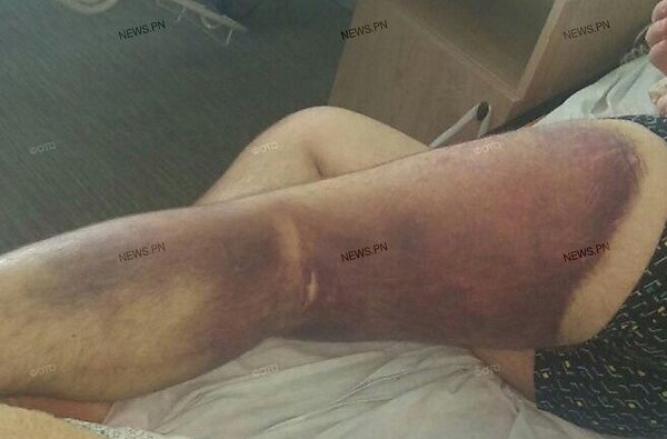 «Где кровь, где моча?!», - николаевец рассказал, как его избивали в Витовском отделении полиции (Видео) | Корабелов.ИНФО image 2