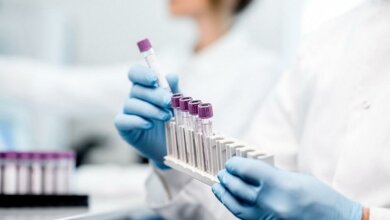 В Украине четвертый день подряд более 800 новых случаев COVID-19 | Корабелов.ИНФО