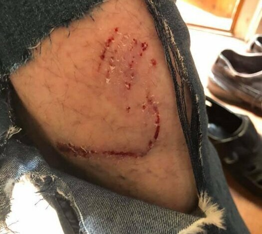 В Николаеве бездомная собака покусала режиссера театра | Корабелов.ИНФО