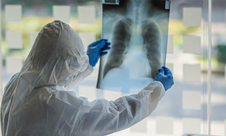 В Украине за минувшие сутки диагноз Covid-19 подтвердился у 1112 человек | Корабелов.ИНФО