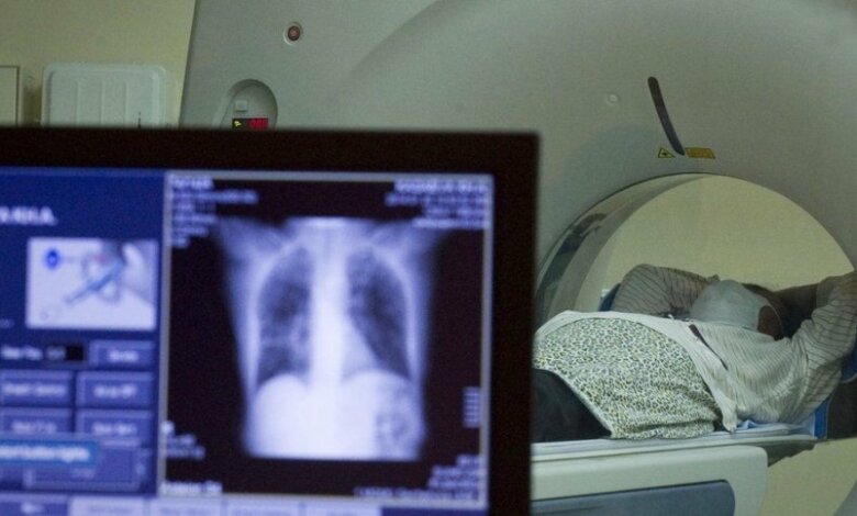 Если больной с COVID-19 не может оплатить КТ, то оплачивает больница, - глава николаевского горздрава | Корабелов.ИНФО