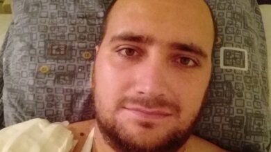 Популярный велоспортсмен из Николаева сильно травмировался: необходимы средства для лечения | Корабелов.ИНФО