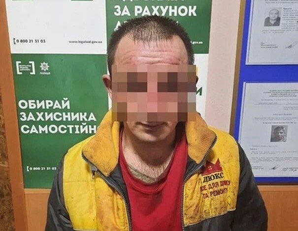 Годовалая девочка, которую отец облил кислотой на Николаевщине, находится в коме (видео) | Корабелов.ИНФО