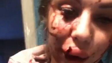 После скандала в соцсети: семейную пару в Корабельном избили на глазах у их дочери. Видео | Корабелов.ИНФО