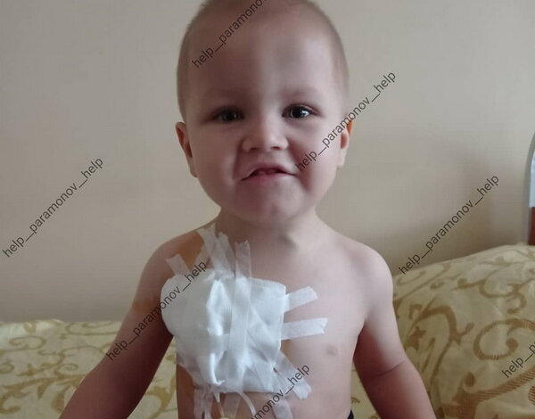 "Улететь за новой жизнью": маленькому жителю Корабельного района нужна помощь добрых сердец | Корабелов.ИНФО