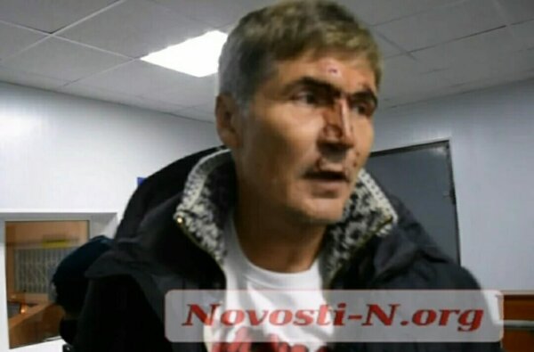 В Николаеве полиция задержала экс-нардепа Жолобецкого: разбили в кровь лицо и надели наручники (видео) | Корабелов.ИНФО