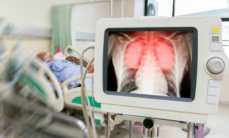 Антирекорд в Николаевской области: за сутки умерли 22 человека с COVID-19 | Корабелов.ИНФО