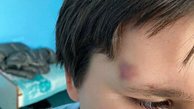 Мама заявила об избиении медработницей 8-летнего мальчика в больнице Николаева | Корабелов.ИНФО