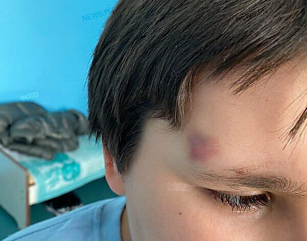 Мама заявила об избиении медработницей 8-летнего мальчика в больнице Николаева | Корабелов.ИНФО