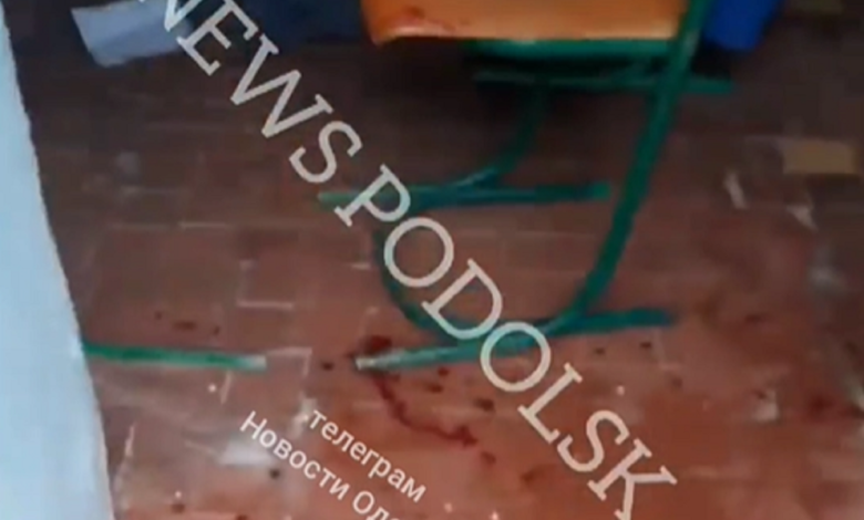 В Одесской области у школьника в руках взорвалась петарда – мальчик лишился пальца | Корабелов.ИНФО