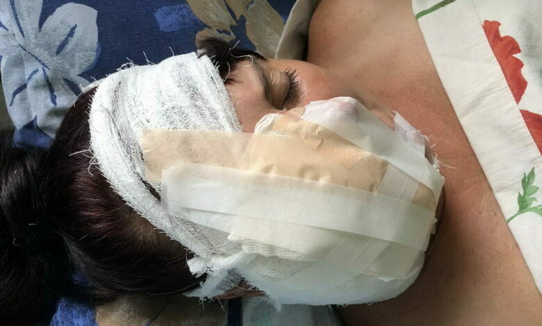 после операции