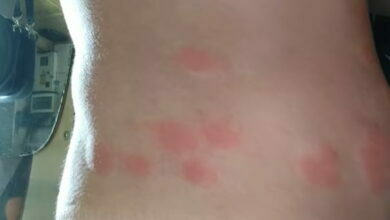 после купания