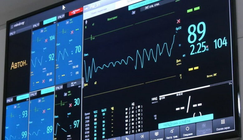 Монитор реанимационной палаты