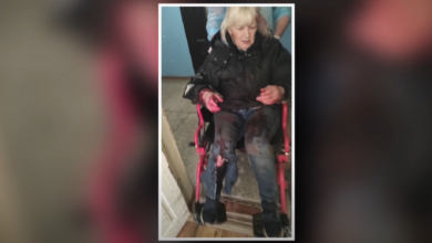 пострадавшая от нападения бешеного пса