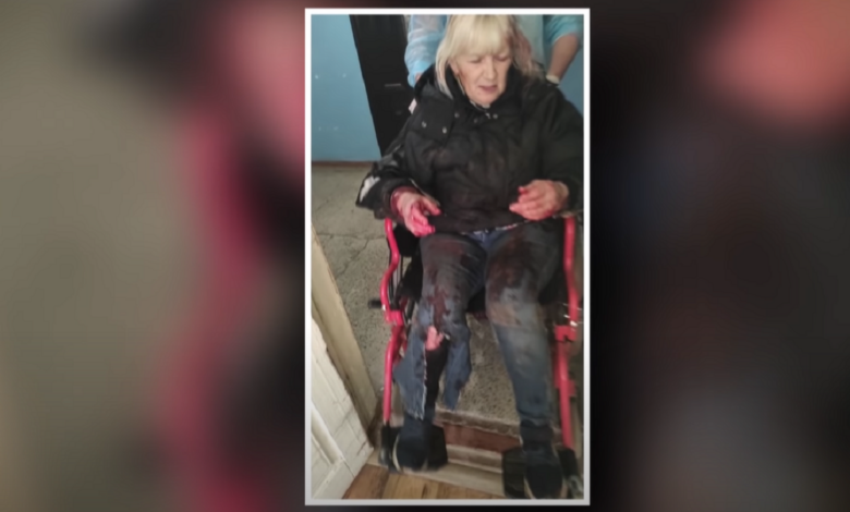 пострадавшая от нападения бешеного пса