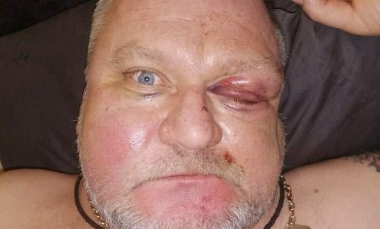 избитый депутат