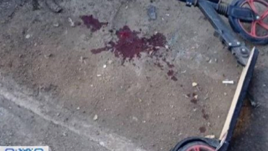 снаряд поранив дитину