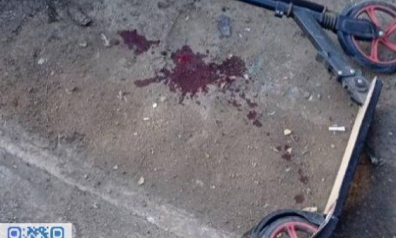 снаряд поранив дитину