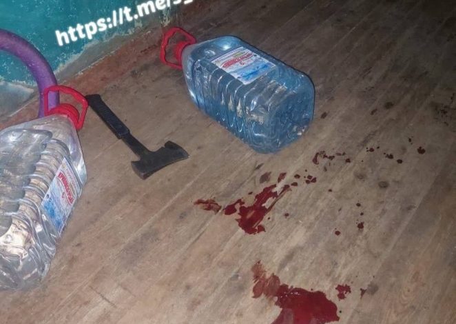 жінка ранила сокирою патрульного