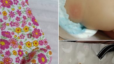 опіки в дитини через недопалок курця