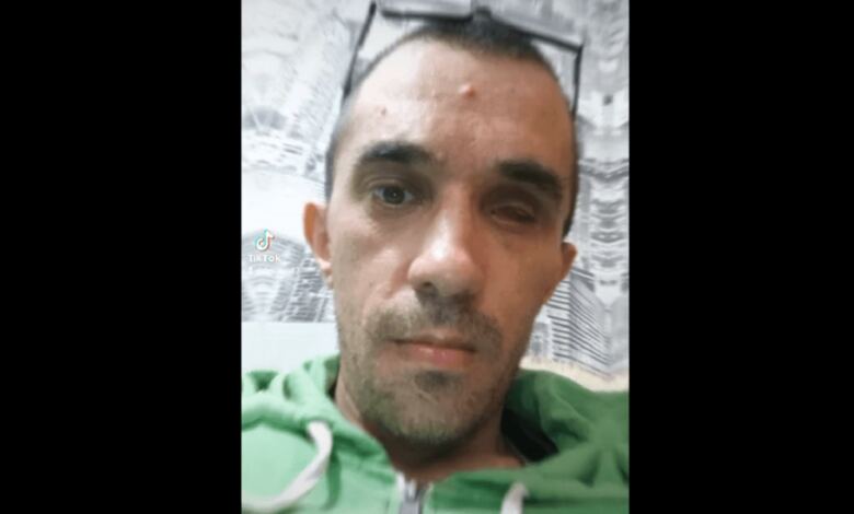 Хлопець з дитинства є інвалідом / скриншот з відео