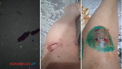 Бродяча собака вкусила мешканку Корабельного району