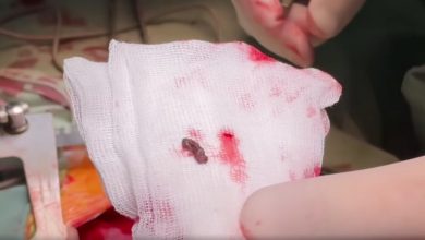 уламок від ворожої міни