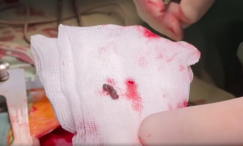уламок від ворожої міни