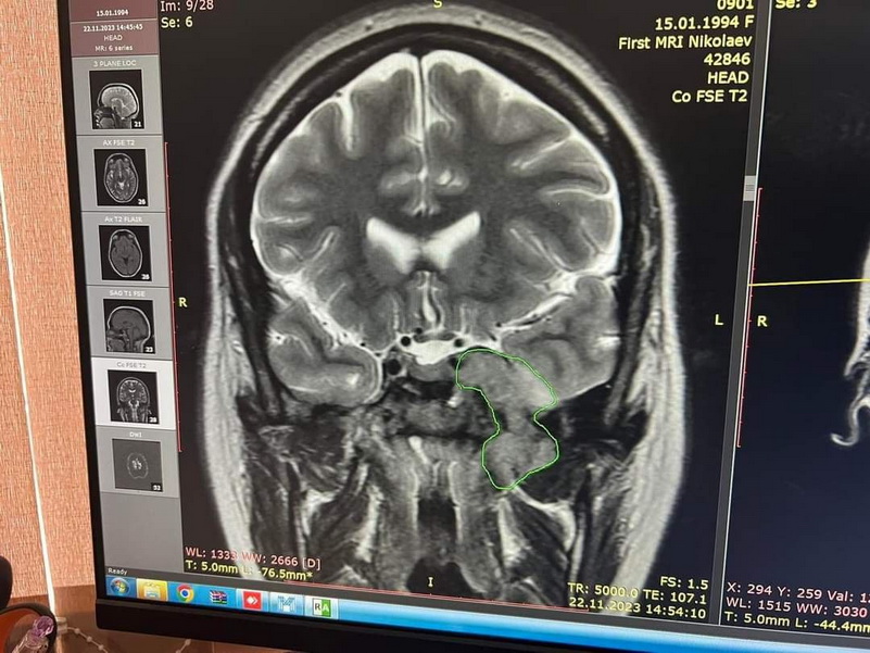 діагноз у Тетяни Коспіревич