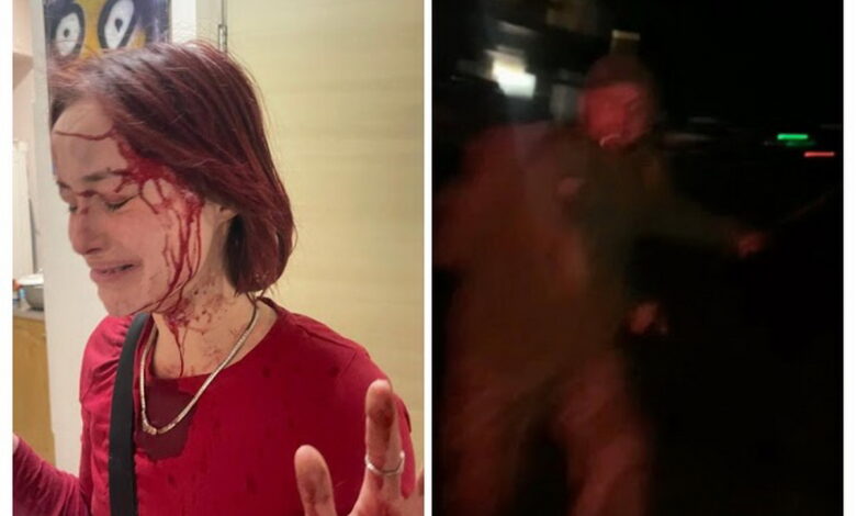 Чоловік у формі побив дівчину милицями в Одесі