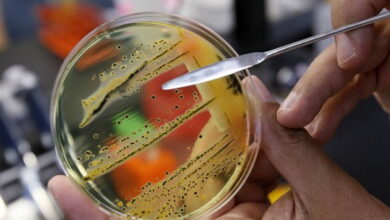 Сальмонела та ботулізм