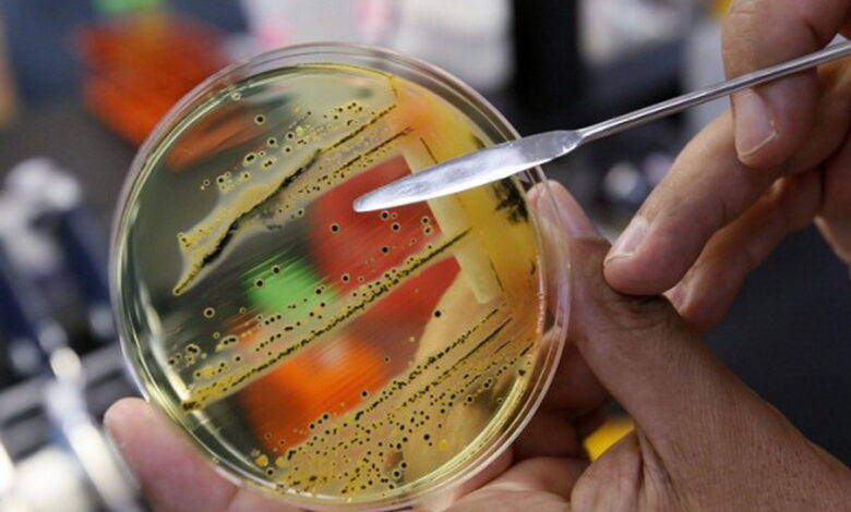 Сальмонела та ботулізм