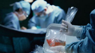 Трансплантація органів