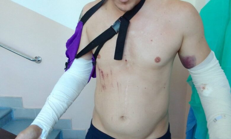 Олексій Прижмирський про тортури