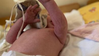Сліди від зв'язування на тілі малюка. Омбудсман Дмитро Лубінець