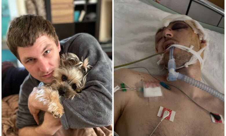 Максим Музичко до та після "мобілізації" (фото Facebook)