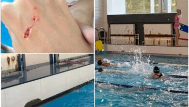 дитина травмувалася у басейні