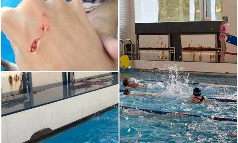 дитина травмувалася у басейні