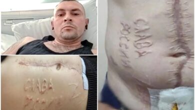 військовополонений після російського лікування