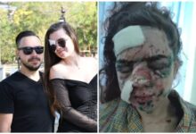 постраждала від вибуху дрона