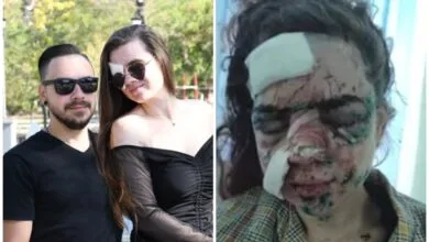 постраждала від вибуху дрона