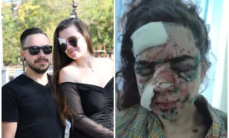 постраждала від вибуху дрона