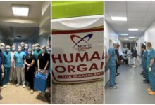 трансплантація органів в Одесі